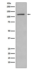 Western blot analysis of Retinoblastoma  phosphorylation expression in Jurkat cell lysate treated with Alkaline Phosphatase.