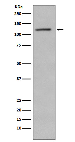 Western blot analysis of Retinoblastoma  phosphorylation expression in Jurkat cell lysate treated with Alkaline Phosphatase.