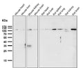 Anti-Rb RB1 Rabbit Monoclonal Antibody