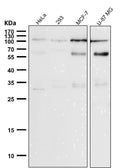 All lanes use the Antibody at 1:1K dilution for 1 hour at room temperature.