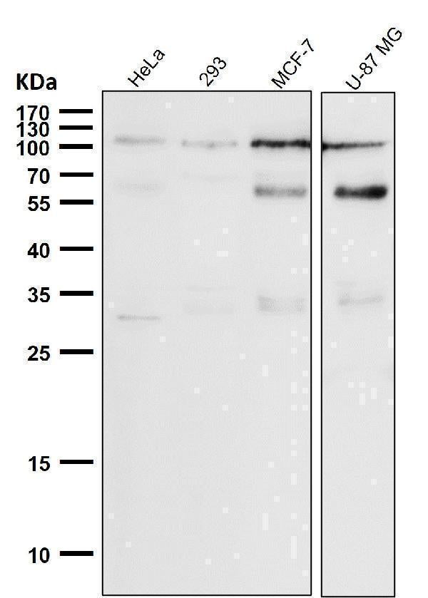 All lanes use the Antibody at 1:1K dilution for 1 hour at room temperature.