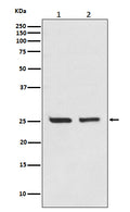 Western blot analysis of Bcl-2 expression in (1) Jurkat cell lysate;(2) MCF-7 cell lysate.