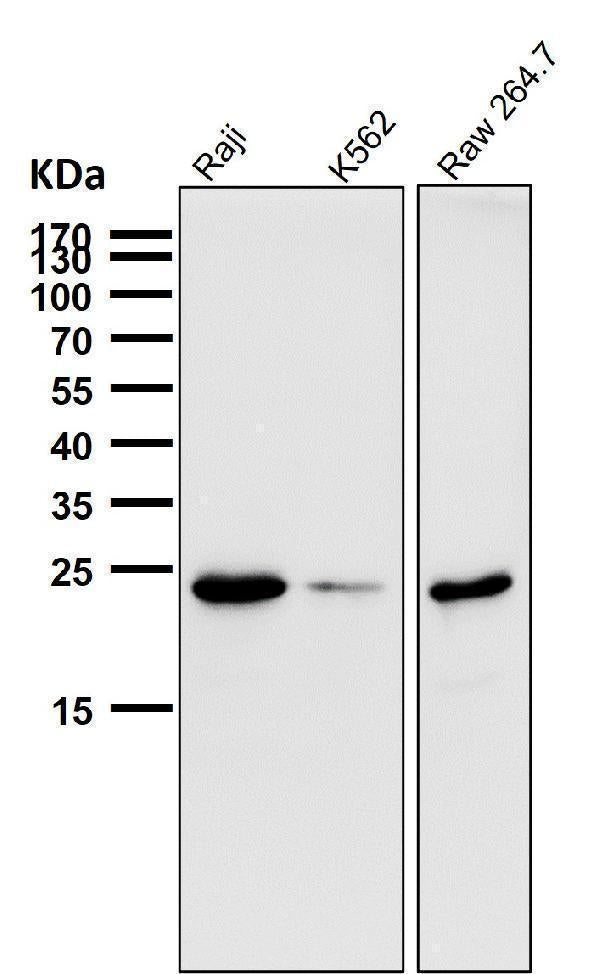 Anti-Bcl-2 Rabbit Monoclonal Antibody