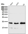 All lanes use the Antibody at 1:4K dilution for 1 hour at room temperature.