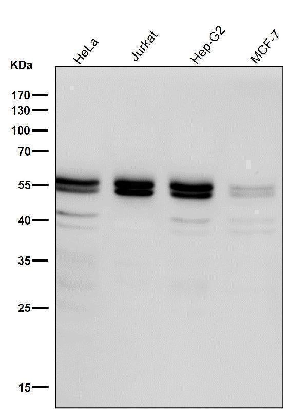 All lanes use the Antibody at 1:1K dilution for 1 hour at room temperature.