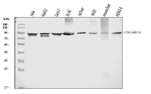 Anti-Prothrombin Antibody Picoband® (monoclonal, 5B6G1)