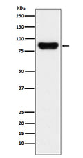 Western blot analysis of Prothrombin expression in human serum lysate.