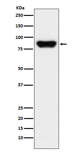 Western blot analysis of Prothrombin expression in human serum lysate.