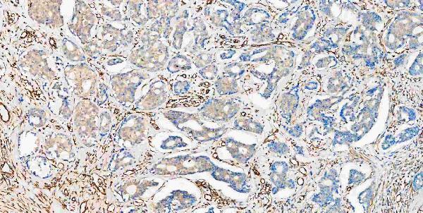 Anti-VEGF VEGFA Rabbit Monoclonal Antibody