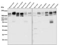All lanes use the Antibody at 1:2K dilution for 1 hour at room temperature.