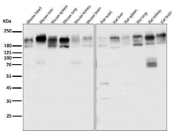 All lanes use the Antibody at 1:2K dilution for 1 hour at room temperature.