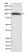 Western blot analysis of KMT6 / EZH2 expression in Hela cell lysate.