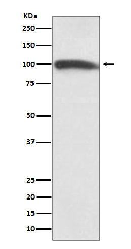 Western blot analysis of KMT6 / EZH2 expression in Hela cell lysate.