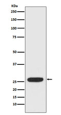 Western blot analysis of StAR expression in SK-BR-3 cell lysate.
