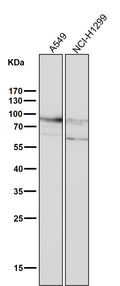 All lanes use the Antibody at 1:2K dilution for 1 hour at room temperature.