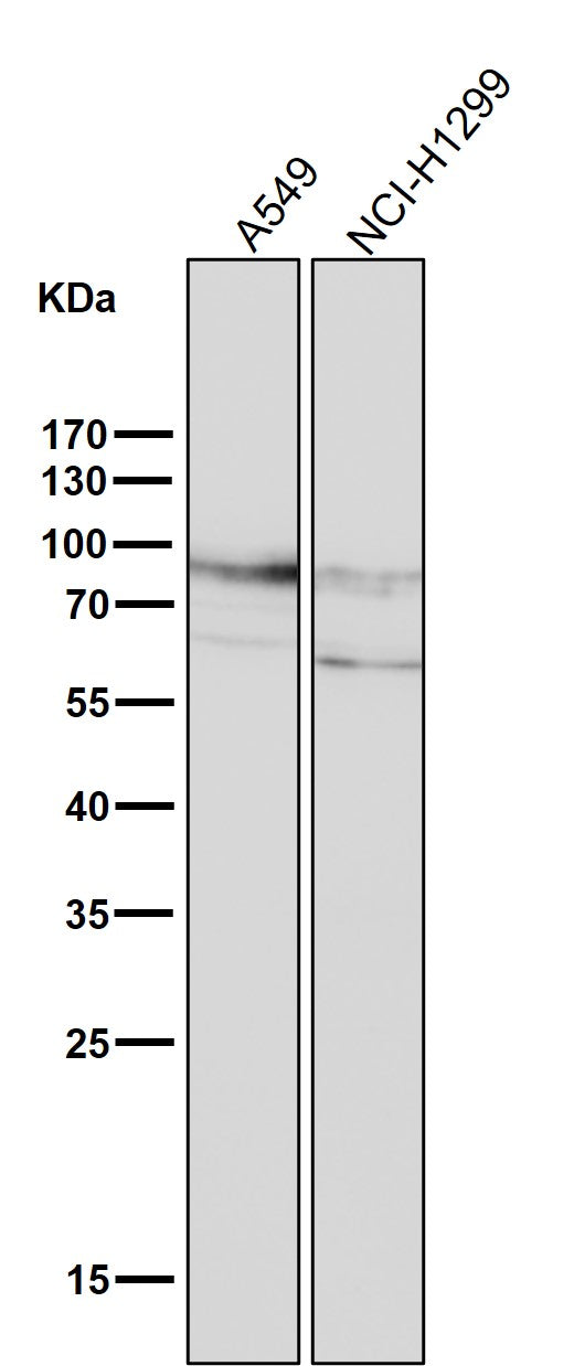 All lanes use the Antibody at 1:2K dilution for 1 hour at room temperature.