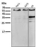 All lanes use the Antibody at 1:1K dilution for 1 hour at room temperature.
