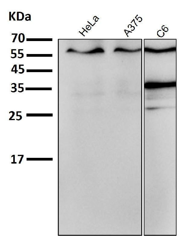 All lanes use the Antibody at 1:1K dilution for 1 hour at room temperature.