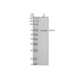 Anti-Estrogen Receptor alpha Rabbit Monoclonal Antibody