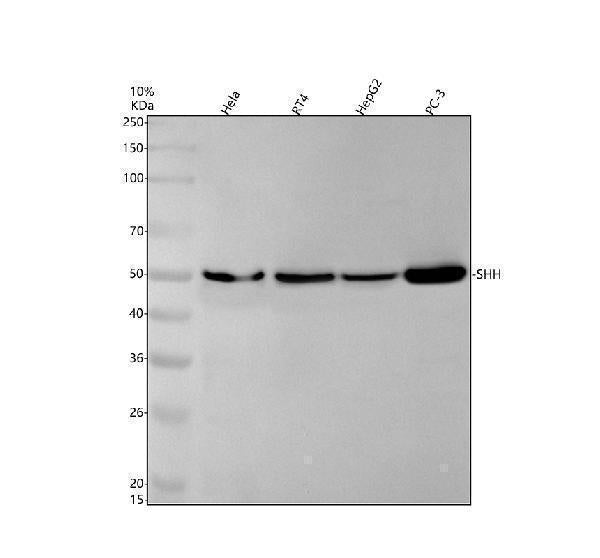 Anti-Sonic Hedgehog SHH Rabbit Monoclonal Antibody