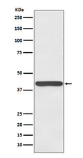 Western blot analysis of Haptoglobin expression in human plasma lysate.
