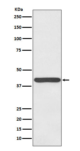 Western blot analysis of Haptoglobin expression in human plasma lysate.