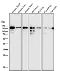 All lanes use the Antibody at 1:1W dilution for 1 hour at room temperature.