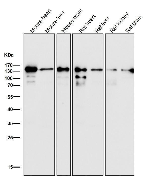 All lanes use the Antibody at 1:1W dilution for 1 hour at room temperature.
