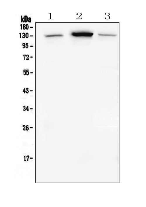 Anti-E Cadherin 1 CDH1 Antibody Picoband® (monoclonal, 9G2)