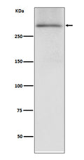 Western blot analysis of Dystrophin expression in human fetal heart lysate.