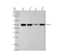 Anti-Aromatase CYP19A1 Rabbit Monoclonal Antibody