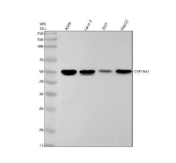 Anti-Aromatase CYP19A1 Rabbit Monoclonal Antibody