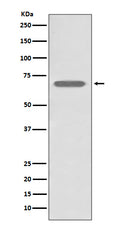 Western blot analysis of beta 2 Adrenergic Receptor expression in A431 cell lysate.