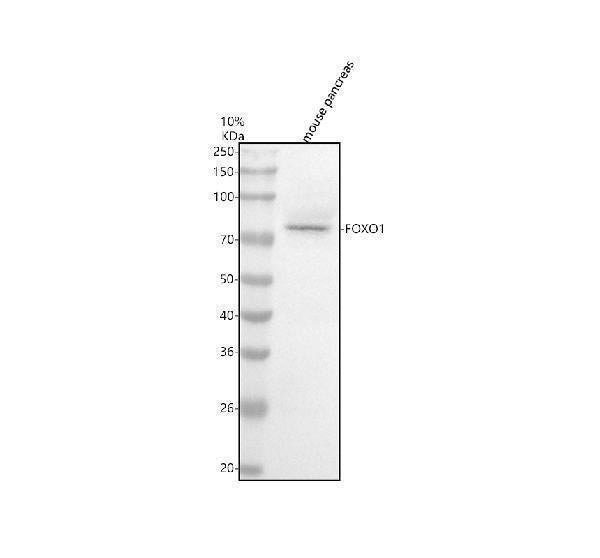 Anti-FoxO1a Rabbit Monoclonal Antibody