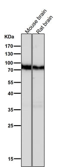 All lanes use the Antibody at 1:2K dilution for 1 hour at room temperature.