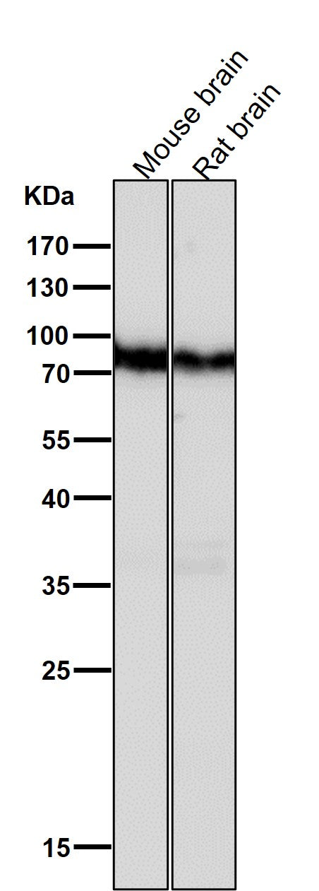 All lanes use the Antibody at 1:2K dilution for 1 hour at room temperature.