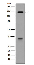 Western blot analysis of LDLR expression in HepG2 cell lysate.