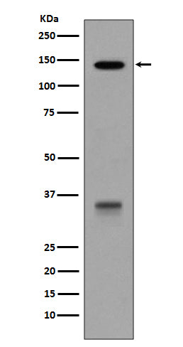 Western blot analysis of LDLR expression in HepG2 cell lysate.