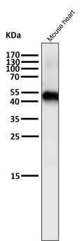 All lanes use the Antibody at 1:1K dilution for 1 hour at room temperature.