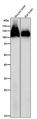 All lanes use the Antibody at 1:3W dilution for 1 hour at room temperature.
