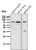 All lanes use the Antibody at 1:1K dilution for 1 hour at room temperature.
