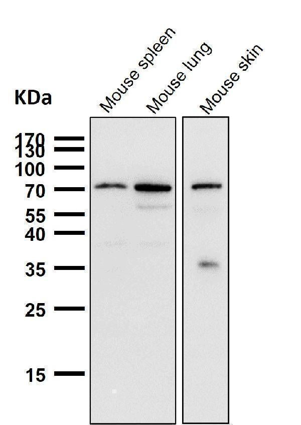 All lanes use the Antibody at 1:1K dilution for 1 hour at room temperature.
