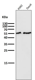 All lanes use the Antibody at 1:5K dilution for 1 hour at room temperature.