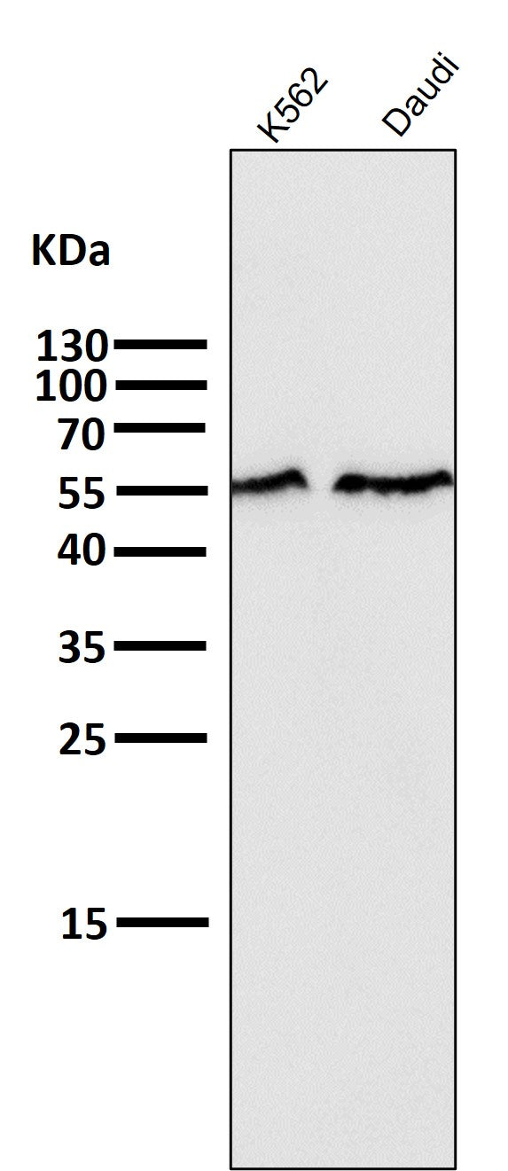 All lanes use the Antibody at 1:5K dilution for 1 hour at room temperature.