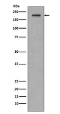 Western blot analysis of PDGF Receptor beta expression in SH-SY5Y cell lysate.