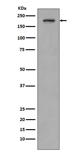 Western blot analysis of PDGF Receptor beta expression in SH-SY5Y cell lysate.
