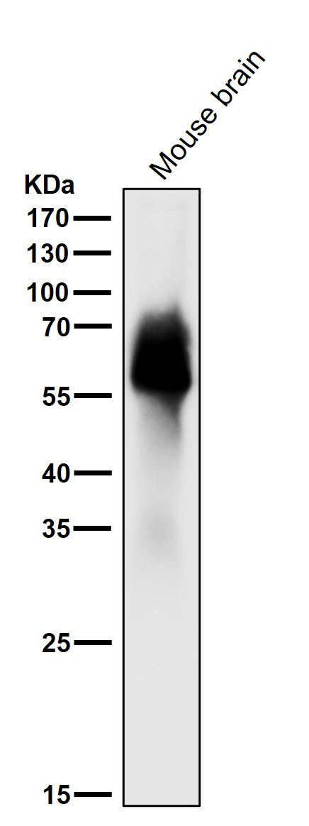 All lanes use the Antibody at 1:1k dilution for 1 hour at room temperature.