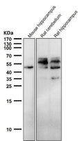 All lanes use the Antibody at 1:2W dilution for 1 hour at room temperature.