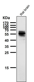 All lanes use the Antibody at 1:1W dilution for 1 hour at room temperature.
