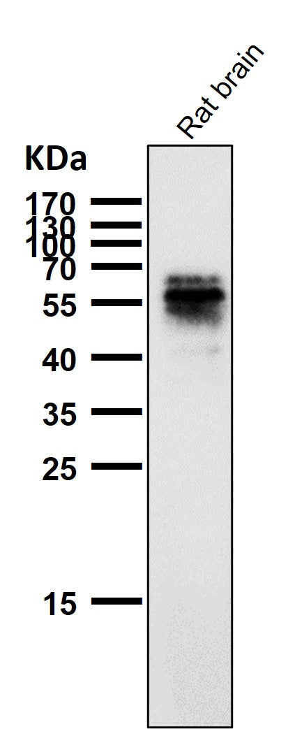 All lanes use the Antibody at 1:1W dilution for 1 hour at room temperature.